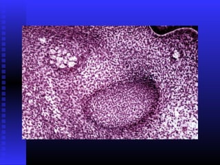 Razvoj lica i vilica