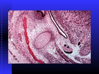 Razvoj lica i vilica