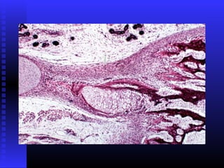 Razvoj lica i vilica