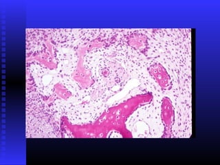 Razvoj lica i vilica