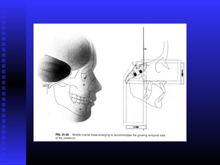 Razvoj lica i vilica