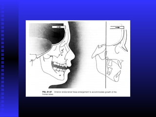 Razvoj lica i vilica