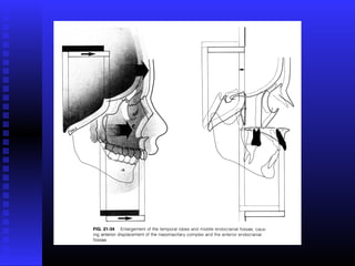 Razvoj lica i vilica