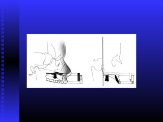 Razvoj lica i vilica