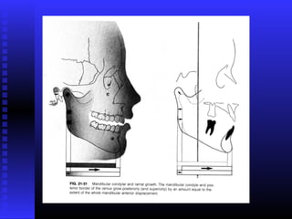 Razvoj lica i vilica