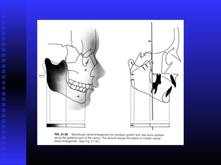 Razvoj lica i vilica
