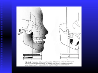 Razvoj lica i vilica