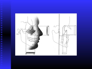 Razvoj lica i vilica