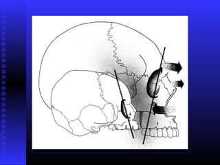 Razvoj lica i vilica