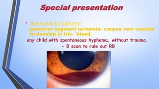 Special presentation
• Spontaneous hyphema
posterior segment ischemia- causes new vessels
to develop in iris- bleed.
any child with spontaneous hyphema, without trauma
- B scan to rule out RB
 