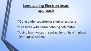 Lens sparing Electron beam
approach
•Done under sedation or short anesthesia
•Eye fixed with beam defining collimater
•Using low – vacuum contact lens – held in place
by magnetic slide.
 
