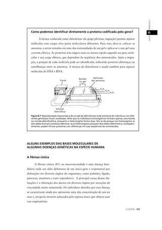 C E D E R J 151
AULAMÓDULO18
ALGUNS EXEMPLOS DAS BASES MOLECULARES DE
ALGUMAS DOENÇAS GENÉTICAS NA ESPÉCIE HUMANA
A ﬁbrose cística
A ﬁbrose cística (FC) ou mucoviscosidade é uma doença here-
ditária onde um alelo defeituoso de um único gene é responsável por
disfunções em diversos órgãos do organismo, como pulmões, fígado,
pâncreas, intestinos e trato reprodutivo. A principal causa dessas dis-
funções é a obstrução dos ductos em diversos órgãos por secreções de
viscosidade muito aumentada. Os indivíduos afetados por essa doença
se caracterizam ainda por apresentar uma alta concentração de sais no
suor e, em geral, morrem sufocados pelo espesso muco que obstrui suas
vias respiratórias.
Como podemos identiﬁcar diretamente a proteína codiﬁcada pelo gene?
A técnica conhecida como eletroforese (do grego phóresis, migração) permite separar
moléculas com cargas e/ou pesos moleculares diferentes. Para isso, deve-se colocar as
amostras a serem testadas em uma das extremidades de um gel e aplica-se a este gel uma
corrente elétrica. As proteínas irão migrar mais ou menos rápido segundo seu peso mole-
cular e sua carga elétrica, que dependem da seqüência dos aminoácidos. Após a migra-
ção, a posição de cada molécula pode ser identiﬁcada, indicando possíveis diferenças ou
semelhanças entre as amostras. A técnica de eletroforese é usada também para separar
moléculas de DNA e RNA.
Figura 8.7: Representação esquemática de um gel de eletroforese onde amostras de indivíduos com dife-
rentes genótipos foram analisadas. Note que os indivíduos homozigóticos formam apenas uma banda
na corrida eletroforética, enquanto o heterozigoto forma duas. Isto se dá porque nos homozigotos os
dois alelos formam proteínas idênticas. Já os heterozigotos possuem dois alelos diferentes e, conseqüen-
temente, podem formar proteínas com diferenças em suas seqüências de aminoácidos.
 
