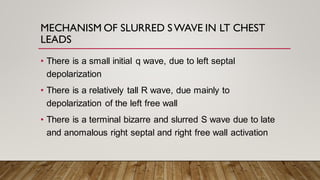 • There is a small initial q wave, due to left septal
depolarization
• There is a relatively tall R wave, due mainly to
depolarization of the left free wall
• There is a terminal bizarre and slurred S wave due to late
and anomalous right septal and right free wall activation
MECHANISM OF SLURRED SWAVE IN LT CHEST
LEADS
 