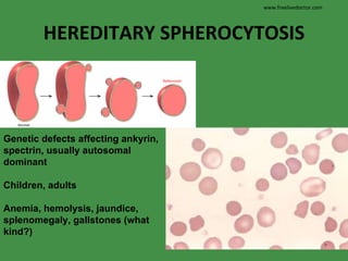 HEREDITARY SPHEROCYTOSIS Genetic defects affecting ankyrin, spectrin, usually autosomal dominant Children, adults Anemia, hemolysis, jaundice, splenomegaly, gallstones (what kind?) www.freelivedoctor.com 