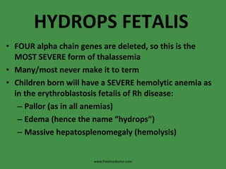 HYDROPS FETALIS FOUR alpha chain genes are deleted, so this is the MOST SEVERE form of thalassemia Many/most never make it to term Children born will have a SEVERE hemolytic anemia as in the erythroblastosis fetalis of Rh disease: Pallor (as in all anemias) Edema (hence the name “hydrops”) Massive hepatosplenomegaly (hemolysis) www.freelivedoctor.com 