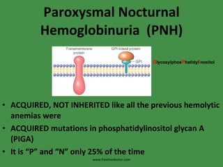 Paroxysmal Nocturnal Hemoglobinuria  (PNH) ACQUIRED, NOT INHERITED like all the previous hemolytic anemias were ACQUIRED mutations in phosphatidylinositol glycan A (PIGA) It is “P” and “N” only 25% of the time G lycosylphos P hatidyl I nositol  www.freelivedoctor.com 