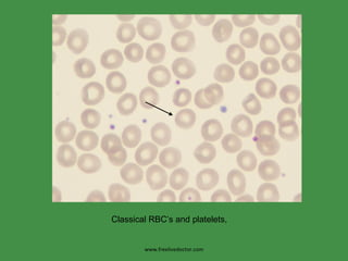 www.freelivedoctor.com Classical RBC’s and platelets,  