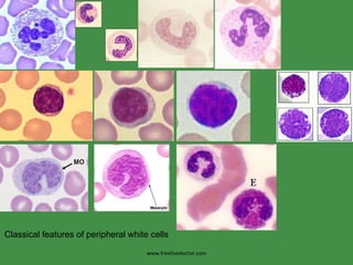 www.freelivedoctor.com Classical features of peripheral white cells 