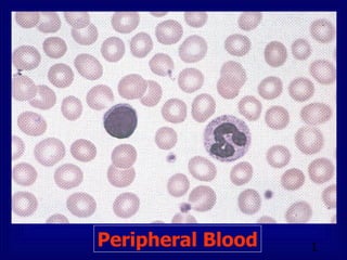 Peripheral Blood 