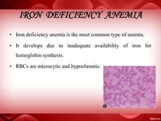 Iron Left In Rbc RBC | PPTX
