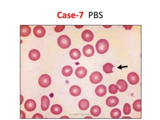 RBC Disorders - case studies | PDF