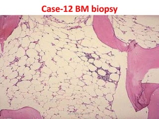 RBC Disorders - case studies | PDF