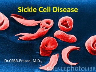 Sickle Cell Disease




Dr.CSBR.Prasad, M.D.,
 