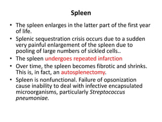 Spleen
• The spleen enlarges in the latter part of the first year
  of life.
• Splenic sequestration crisis occurs due to a sudden
  very painful enlargement of the spleen due to
  pooling of large numbers of sickled cells..
• The spleen undergoes repeated infarction
• Over time, the spleen becomes fibrotic and shrinks.
  This is, in fact, an autosplenectomy.
• Spleen is nonfunctional. Failure of opsonization
  cause inability to deal with infective encapsulated
  microorganisms, particularly Streptococcus
  pneumoniae.
 