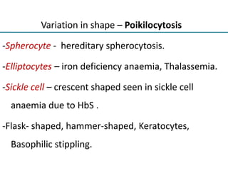 Variation in shape – Poikilocytosis
-Spherocyte - hereditary spherocytosis.
-Elliptocytes – iron deficiency anaemia, Thalassemia.
-Sickle cell – crescent shaped seen in sickle cell
anaemia due to HbS .
-Flask- shaped, hammer-shaped, Keratocytes,
Basophilic stippling.
 