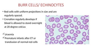 Mild Crenation Rbc rbc ajin (1).pptx rbc morphology, morphology | PPTX