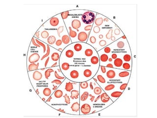 Isomorphic Rrbc Rbc disorders | PPTX