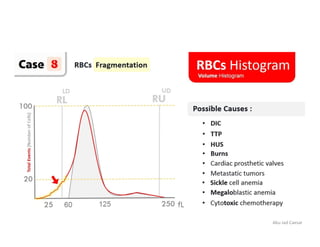 RBC Histogram | PDF