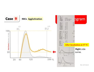 Abu Jad Caesar
After incubation at 37 °C