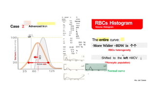 Wide Rbc Histogram RBC HISTOGRAM and cell blood counts.pptx