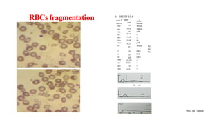 RBC HISTOGRAM and cell blood counts.pptx