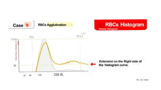 RBC HISTOGRAM and cell blood counts.pptx