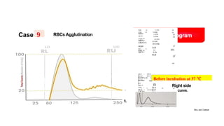 RBC HISTOGRAM and cell blood counts.pptx