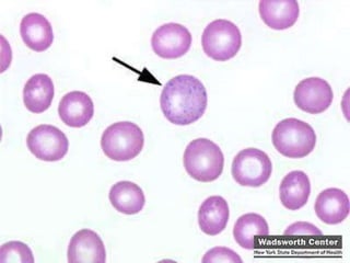 Rbc inclusion ())))) | PPTX