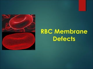 RBC Membrane
Defects
 