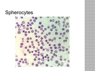 Spherocytes
 