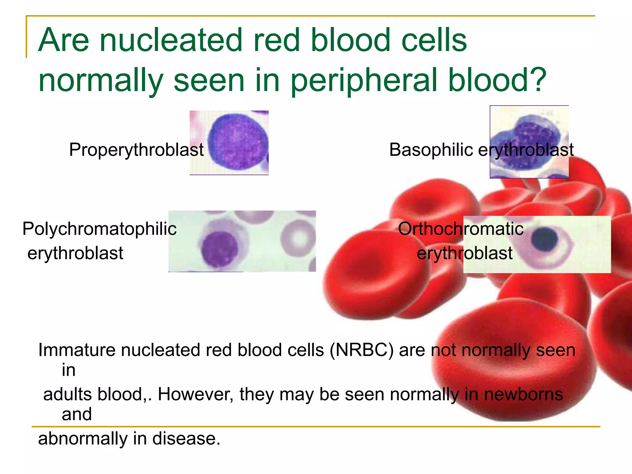 RBC morphology and Disease that may be associated with abnormal ...