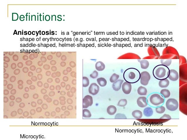 rbc morphology abnormal