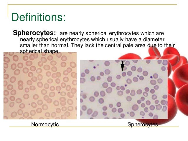 rbc morphology abnormal