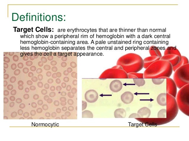 target cell