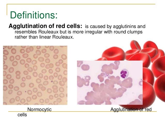 rbc morphology