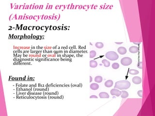 RBC Morphology.pdf