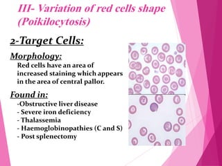 Polymorphic Rbc RBC Morphology.pdf