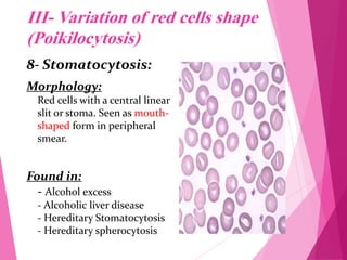 RBC Morphology.pdf