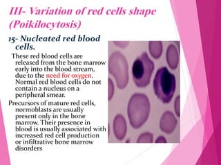 Variation In Rbc Shape RBC Morphology.pdf