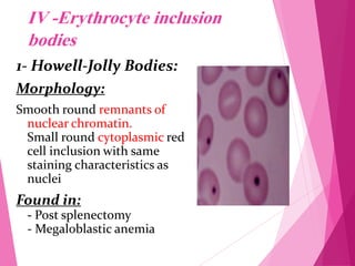 Chromatin Rbc RBC Morphology.pdf